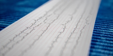 How to perform ECG categorization and detect arrhythmia